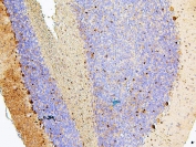 IHC staining of FFPE rat brain with MTR antibody. HIER: boil tissue sections in pH6, 10mM citrate buffer, for 20 min and allow to cool before testing.