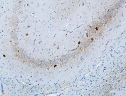 IHC staining of FFPE rat brain with MTR antibody. HIER: boil tissue sections in pH6, 10mM citrate buffer, for 20 min and allow to cool before testing.