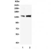 Western blot testing of human 1) placenta and 2) K562 lysate with MTR antibody. Predicted molecular weight: ~140 kDa.