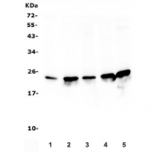 Western blot testing of human 1) placenta, 2) HEK293, 3) A549, 4) HepG2 and 5) K562 lysate with RPL13A antibody. Predicted molecular weight ~23 kDa.