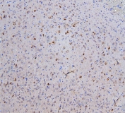 IHC staining of FFPE rat brain with SKP1 antibody. HIER: boil tissue sections in pH6, 10mM citrate buffer, for 20 min and allow to cool before testing.