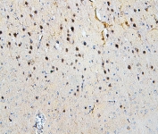 IHC staining of FFPE mouse brain with SKP1 antibody. HIER: boil tissue sections in pH6, 10mM citrate buffer, for 20 min and allow to cool before testing.