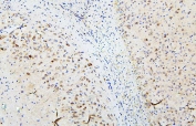 IHC staining of FFPE rat brain with SKP1 antibody. HIER: boil tissue sections in pH6, 10mM citrate buffer, for 20 min and allow to cool before testing.