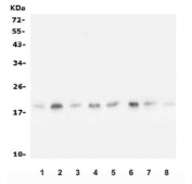 Western blot testing of human 1) U-87 MG, 2) T-47D, 3) Caco-2, 4) PC-3, 5) K562, 6) rat brain, 7) mouse brain and 8) mouse RAW264.7 lysate with SKP1 antibody. Predicted molecular weight ~19 kDa.
