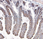 IHC staining of FFPE rat intestine with MVP antibody. HIER: boil tissue sections in pH6, 10mM citrate buffer, for 20 min and allow to cool before testing.