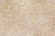 IHC staining of FFPE mouse liver with Gusb antibody. HIER: boil tissue sections in pH6, 10mM citrate buffer, for 20 min and allow to cool before testing.