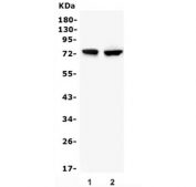 Western blot testing of 1) rat liver and 2) mouse liver lysate with Gusb antibody. Expected molecular weight: 68-75 kDa, also seen as dimers and tetramers.