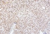 IHC staining of FFPE mouse liver with Histone H1.0 antibody. HIER: boil tissue sections in pH6, 10mM citrate buffer, for 20 min and allow to cool before testing.