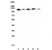 Western blot testing of human 1) U-87 MG, 2) U-2 OS, 3) PC-3, 4) A549 and 5) HepG2 lysate with HIF-1 alpha antibody. Routinely observed molecular weight: 100~120 kDa.
