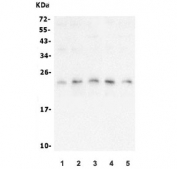 Western blot testing of human 1) HEK293, 2) K562, 3) Caco-2, 4) Raji and 5) A549 lysate with mtTFA antibody. Expected molecular weight: 24~29 kDa.