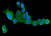 IF/ICC staining of FFPE human MCF7 cells with CLPX antibody (green) at 2ug/ml and DAPI nuclear stain (blue). HIER: steam section in pH6 citrate buffer for 20 min.