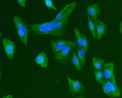 IF/ICC staining of FFPE human U-2 OS cells with Beta Tubulin antibody (green) at 2ug/ml and DAPI nuclear stain (blue). HIER: steam section in pH6 citrate buffer for 20 min.