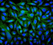 IF/ICC staining of FFPE human U-2 OS cells with Beta Tubulin antibody (green) at 2ug/ml and DAPI nuclear stain (blue). HIER: steam section in pH6 citrate buffer for 20 min.