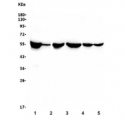 Western blot testing of rat 1) brain, 2) liver, 3) PC-12 and mouse 4) brain, 5) NIH3T3 and 6) RAW264.7 cell lysate with Beta Tubulin antibody. Predicted molecular weight: 50-55 kDa.