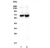 Western blot testing of human 1) Jurkat and 2) CCRM-CEM lysate with CD5 antibody. Observed molecular weight: 55~67 kDa depending on glycosylation level.