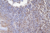 IHC staining of FFPE human tonsil with CD5 antibody. HIER: boil tissue sections in pH6, 10mM citrate buffer, for 20 min and allow to cool before testing.