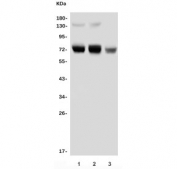Western blot testing of 1) human HL-60, 2) rat thymus and 3) mouse kidney lysate with PRMT5 antibody. Expected molecular weight ~72 kDa.