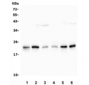 Western blot testing of 1) rat liver, 2) rat PC-12, 3) mouse liver, 4) mouse kidney, 5) mouse NIH 3T3 and 6) mouse HEPA1-6 lysate with PTGES3 antibody. Predicted molecular weight ~23 kDa.