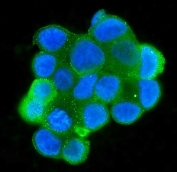 Immunofluorescent staining of FFPE human MCF7 cells with MPI antibody (green) and DAPI nuclear stain (blue). HIER: steam section in pH6 citrate buffer for 20 min.