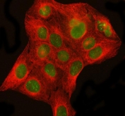 Immunofluorescent staining of FFPE human U-2 OS cells with DHX15 antibody (green) and Beta Tubulin mAb (red). HIER: steam section in pH6 citrate buffer for 20 min.