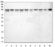 Western blot testing of 1) human HeLa, 2) human 293T, 3) human Caco-2, 4) human HEL, 5) human RT4, 6) human A549, 7) human A431, 8) human U-251, 9) rat C6 and 10) mouse thymus tissue lysate with DHX15 antibody. Predicted molecular weight ~91 kDa.