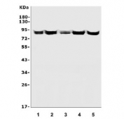 Western blot testing of human 1) HeLa, 2) Jurkat, 3) SW620, 4) T-47D and 5) Raji lysate with HMMR antibody. Expected molecular weight ~72 kDa (cell surface form) and 85-95 kDa (intracellular form).