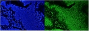 Immunofluorescent staining of FFPE human intestinal cancer with AUF1 antibody (green) and DAPI nuclear stain (blue). HIER: steam section in pH6 citrate buffer for 20 min.