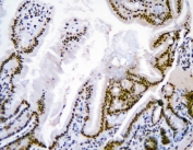 IHC staining of FFPE mouse intestine with AUF1 antibody. HIER: boil tissue sections in pH8 EDTA for 20 min and allow to cool before testing.