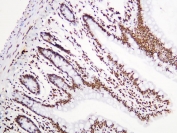 IHC staining of FFPE rat intestine with AUF1 antibody. HIER: boil tissue sections in pH8 EDTA for 20 min and allow to cool before testing.