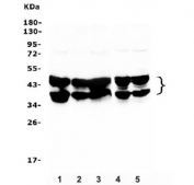 Western blot testing of human 1) placenta, 2) HEK293, 3) HL-60, 4) K562, 5) A431, 6) HepG2 and 7) Caco-2 lysate with AUF1 antibody. Expected molecular weight: multiple bands from 37-45 kDa. 