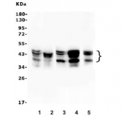 Western blot testing of 1) rat brain, 2) rat thymus, 3) mouse brain, 4) mouse thymus and 5) mouse SP2/0 lysate with AUF1 antibody. Expected molecular weight: multiple bands from 37-45 kDa. 