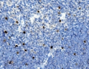 IHC staining of FFPE mouse thymus with MAFA antibody. HIER: boil tissue sections in pH8 EDTA for 20 min and allow to cool before testing.