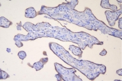 IHC staining of FFPE human placenta with HSD3B1 antibody. HIER: boil tissue sections in pH8 EDTA for 20 min and allow to cool before testing.