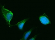 Immunofluorescent staining of FFPE human U-2 OS cells with HSD3B1 antibody (green) and DAPI nuclear stain (blue). HIER: steam section in pH6 citrate buffer for 20 min.