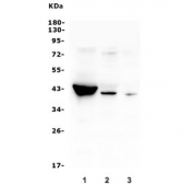 Western blot testing of human 1) placenta, 2) Caco-2 and 3) MDA-MB-453 lysate with HSD3B1 antibody. Predicted molecular weight ~42 kDa.