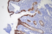 IHC staining of FFPE human appendix with Keratin 20 antibody. HIER: boil tissue sections in pH8 EDTA for 20 min and allow to cool before testing.