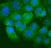 Immunofluorescent staining of FFPE human A431 cells with Keratin 20 antibody (green) and DAPI nuclear stain (blue). HIER: steam section in pH6 citrate buffer for 20 min.