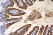 IHC staining of FFPE mouse intestine with Keratin 20 antibody. HIER: boil tissue sections in pH8 EDTA for 20 min and allow to cool before testing.