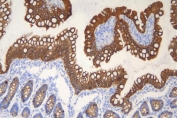 IHC staining of FFPE rat intestine with Keratin 20 antibody. HIER: boil tissue sections in pH8 EDTA for 20 min and allow to cool before testing.