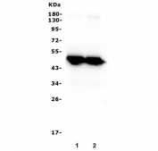 Western blot testing of 1) human Caco-2 and 2) mouse small intestine lysate with Keratin 20 antibody. Predicted molecular weight ~48 kDa.