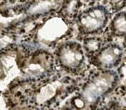 IHC staining of FFPE mouse intestine with LRPPRC antibody. HIER: boil tissue sections in pH8 EDTA for 20 min and allow to cool before testing.