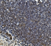 IHC staining of FFPE rat intestine with LRPPRC antibody. HIER: boil tissue sections in pH8 EDTA for 20 min and allow to cool before testing.