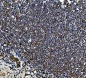 IHC staining of FFPE rat intestine with LRPPRC antibody. HIER: boil tissue sections in pH8 EDTA for 20 min and allow to cool before testing.