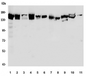 Western blot testing of human 1) HEK293, 2) HeLa, 3) Jurkat and 4) Caco-2, 5) monkey kindey, 6) monkey heart, 7) rat heart, 8) rat skeletal muscle, 9) rat kidney, 10) rat liver and 11) mouse heart lysate with LRPPRC antibody. Expected molecular weight: 150-160 kDa.