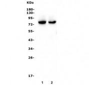 Western blot testing of 1) rat testis and 2) mouse testis lysate with DDX4 antibody. Predicted molecular weight ~79 kDa.