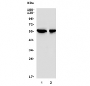 Western blot testing of 1) human HeLa and 2) monkey kidney lysate with SGK1 antibody. Expected molecular weight: 45-60 kDa.