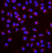 Immunofluorescent staining of FFPE human U-2 OS cells with SGK1 antibody (red) and DAPI nuclear stain (blue). HIER: steam section in pH6 citrate buffer for 20 min.