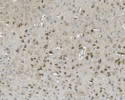 IHC staining of FFPE rat brain with TXN2 antibody. HIER: boil tissue sections in pH8 EDTA for 20 min and allow to cool before testing.
