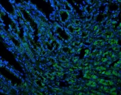 Immunofluorescent staining of FFPE human intestinal cancer with TXN2 antibody (green) and DAPI nuclear stain (blue). HIER: steam section in pH8 EDTA for 20 min.