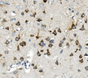 IHC staining of FFPE rat brain with TXN2 antibody. HIER: boil tissue sections in pH8 EDTA for 20 min and allow to cool before testing.